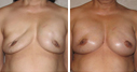 Before & After Photos